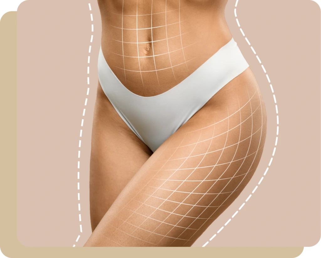 Add-On Procedures for body contouring