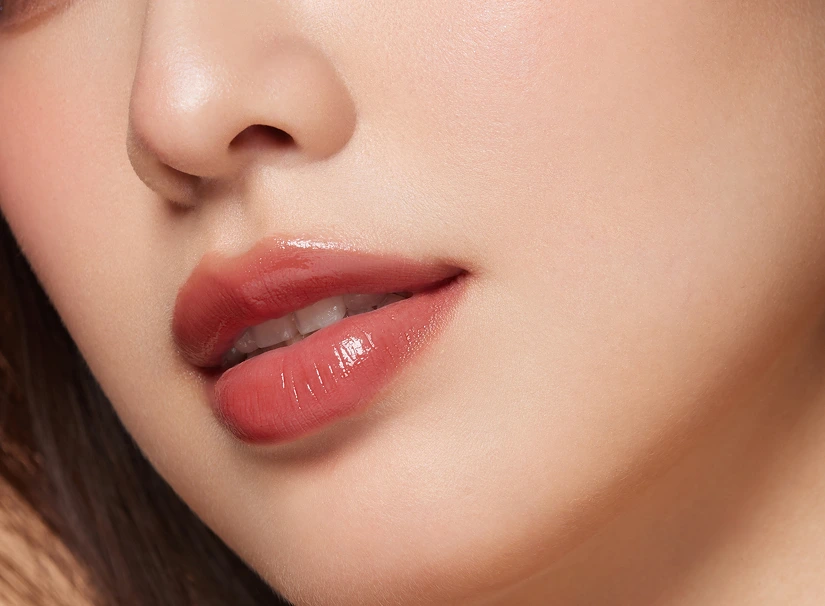 Candidates for Lip Fillers Banner
