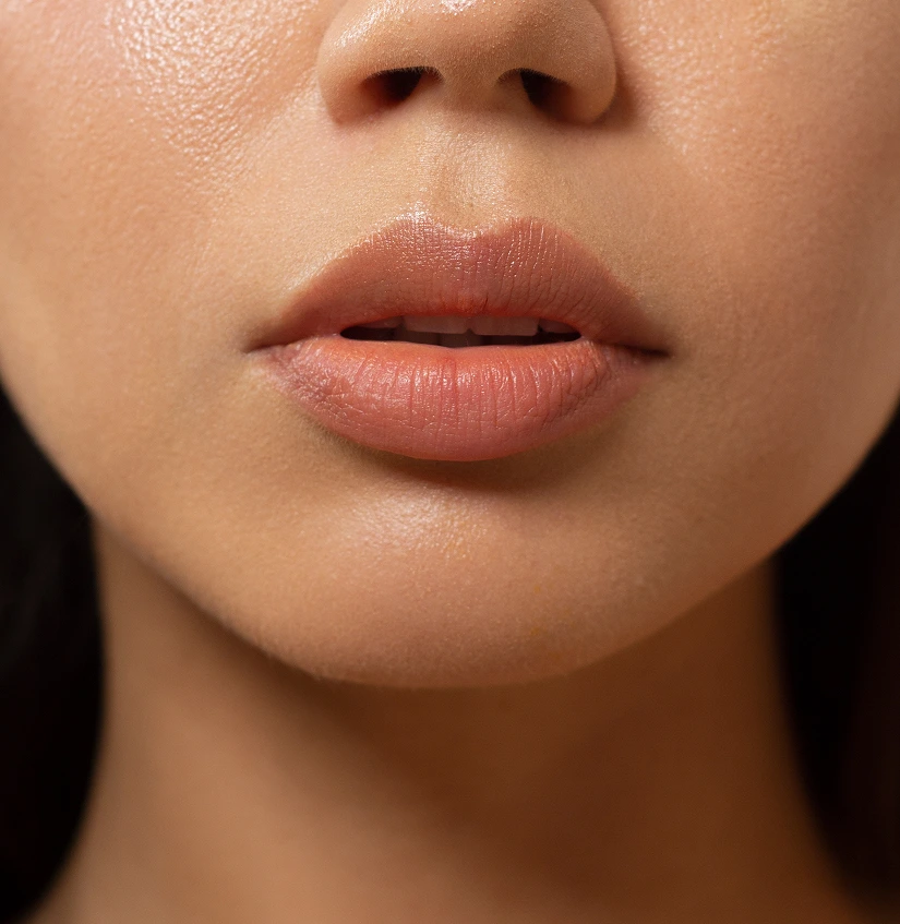 Lip Filler Procedure: An Overview Banner