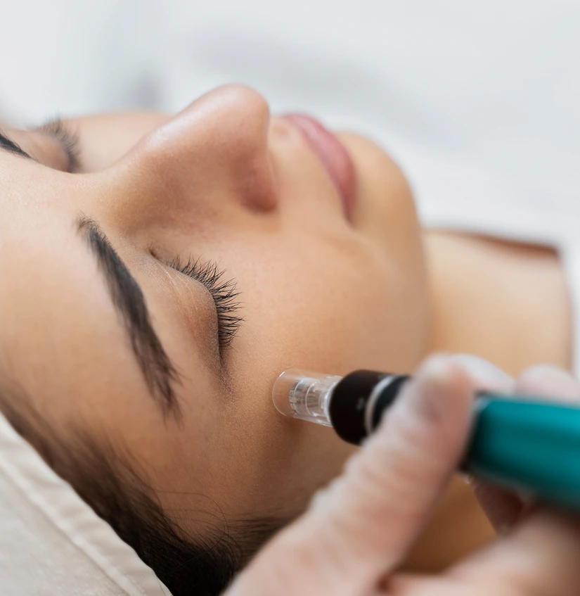 Microneedling Procedure Banner
