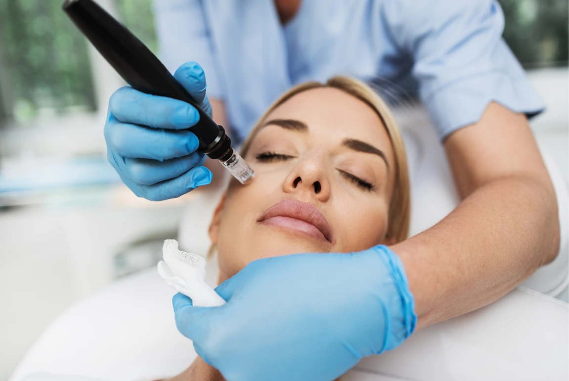 What Is Microneedling With PRP In Philadelphia, PA Banner