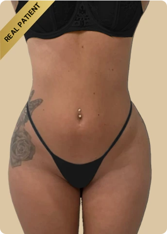 Weight Loss Injections