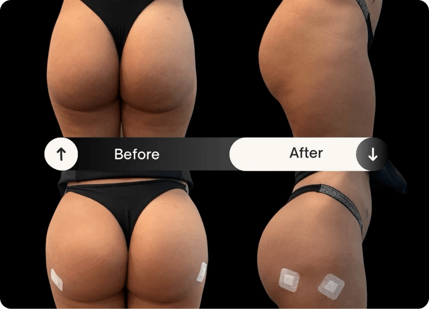 liquid bbl before and after pictures