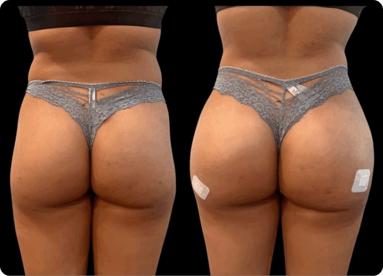 Liquid BBL Archives | LSWC