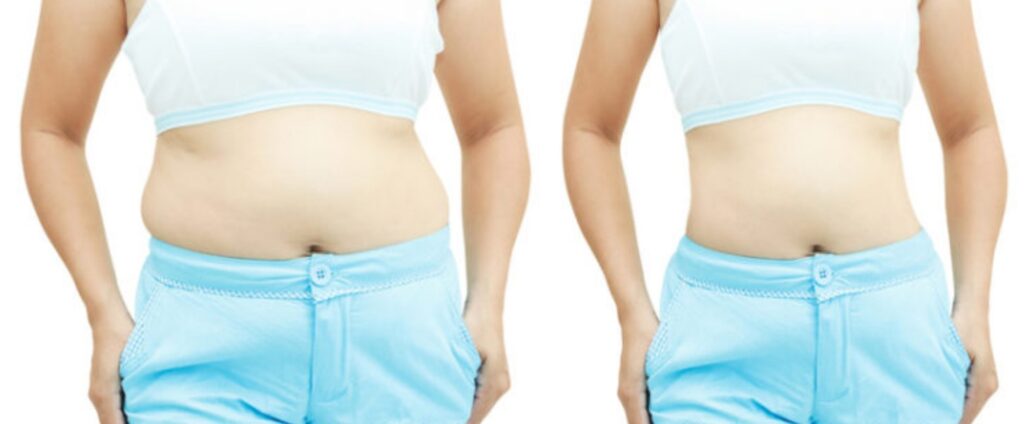 Before and after weight loss