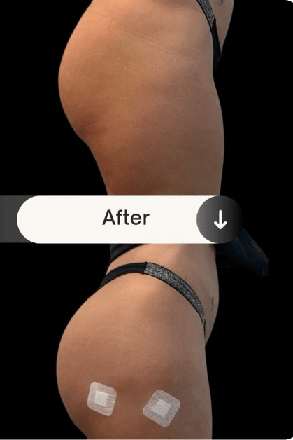 liquid bbl before and after pictures